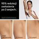 Депилятор BRAUN Silk&middot;expert Pro 5 IPL PL5431 с датчиком Smart SkinProtect 2112574 фото 5