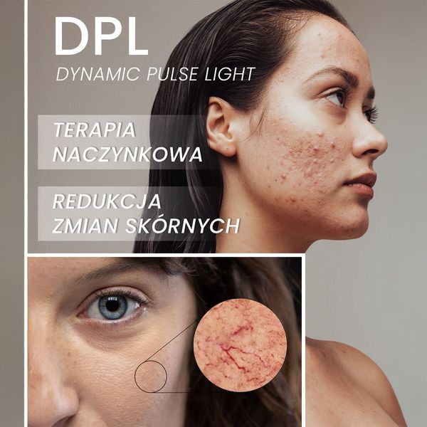 Депилятор BEAUTIFLY Golden Luminare Rejuva Skin Visage IPL DPL NIR 2135531 фото